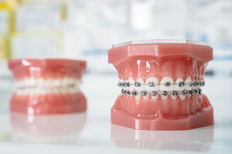 brackets