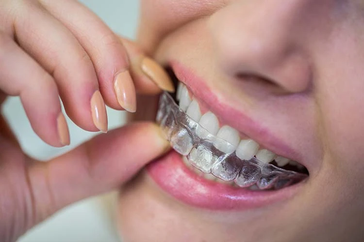 Brackets